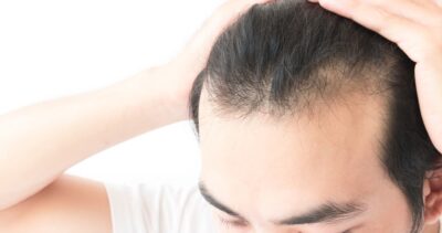 Tips voor mannen met dun haar
