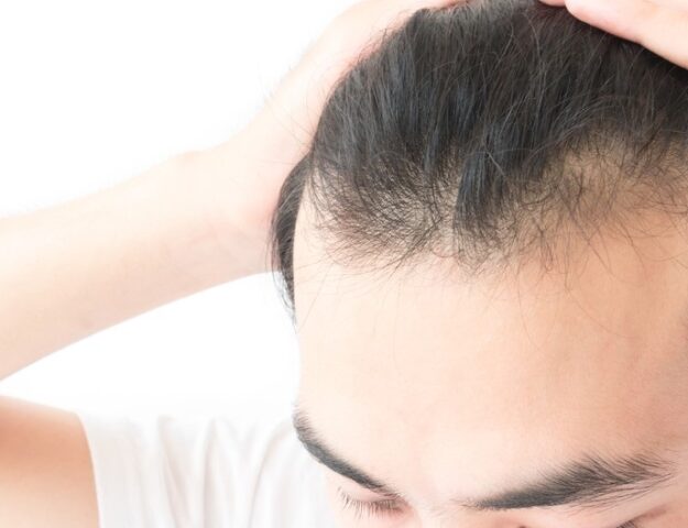 Tips voor mannen met dun haar